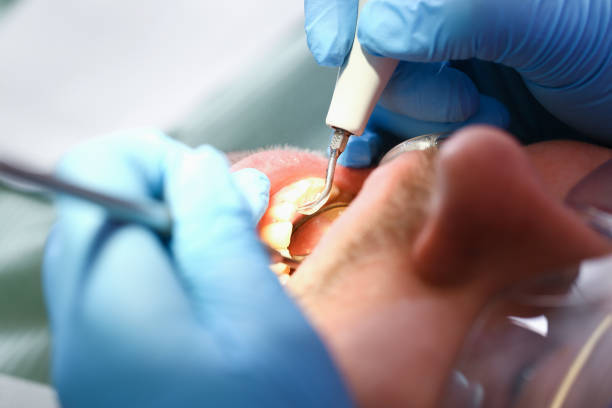 Best Emergency Denture Repair in Ashville, OH