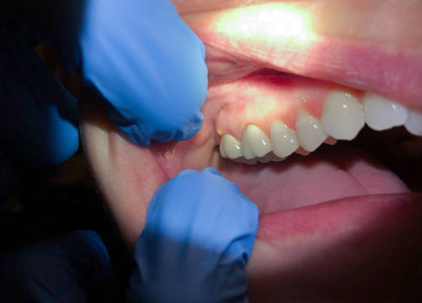 Best After-Hours Dental Trauma Care in Ashville, OH