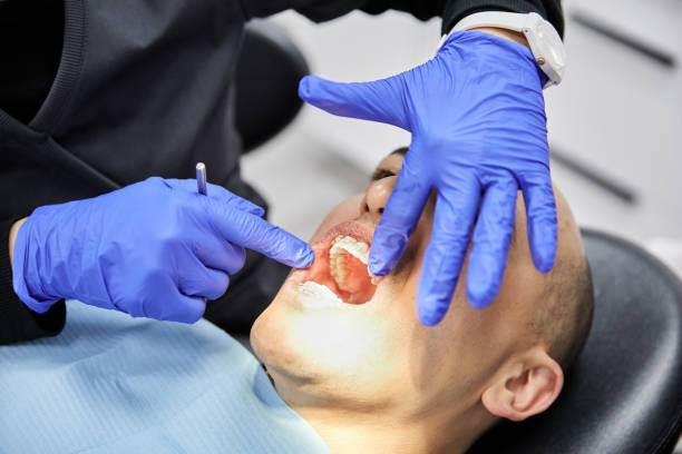 Best Emergency Tooth Extraction in Ashville, OH